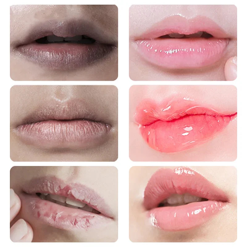DARK LIP BALM LIGHTENING