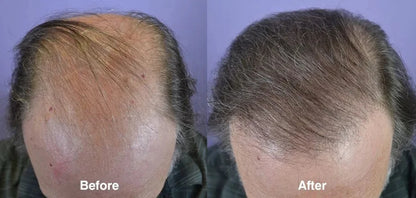 GINGER HAIR CARE OIL